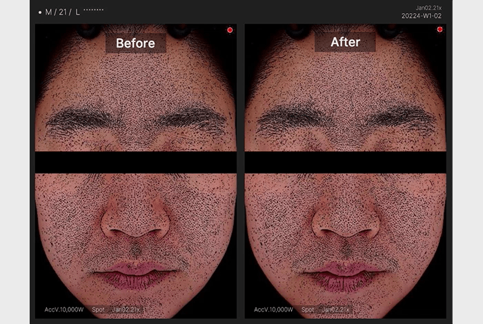 Medicube Pads exfoliants zéro pore 2.0 (70 pads) – Image 10