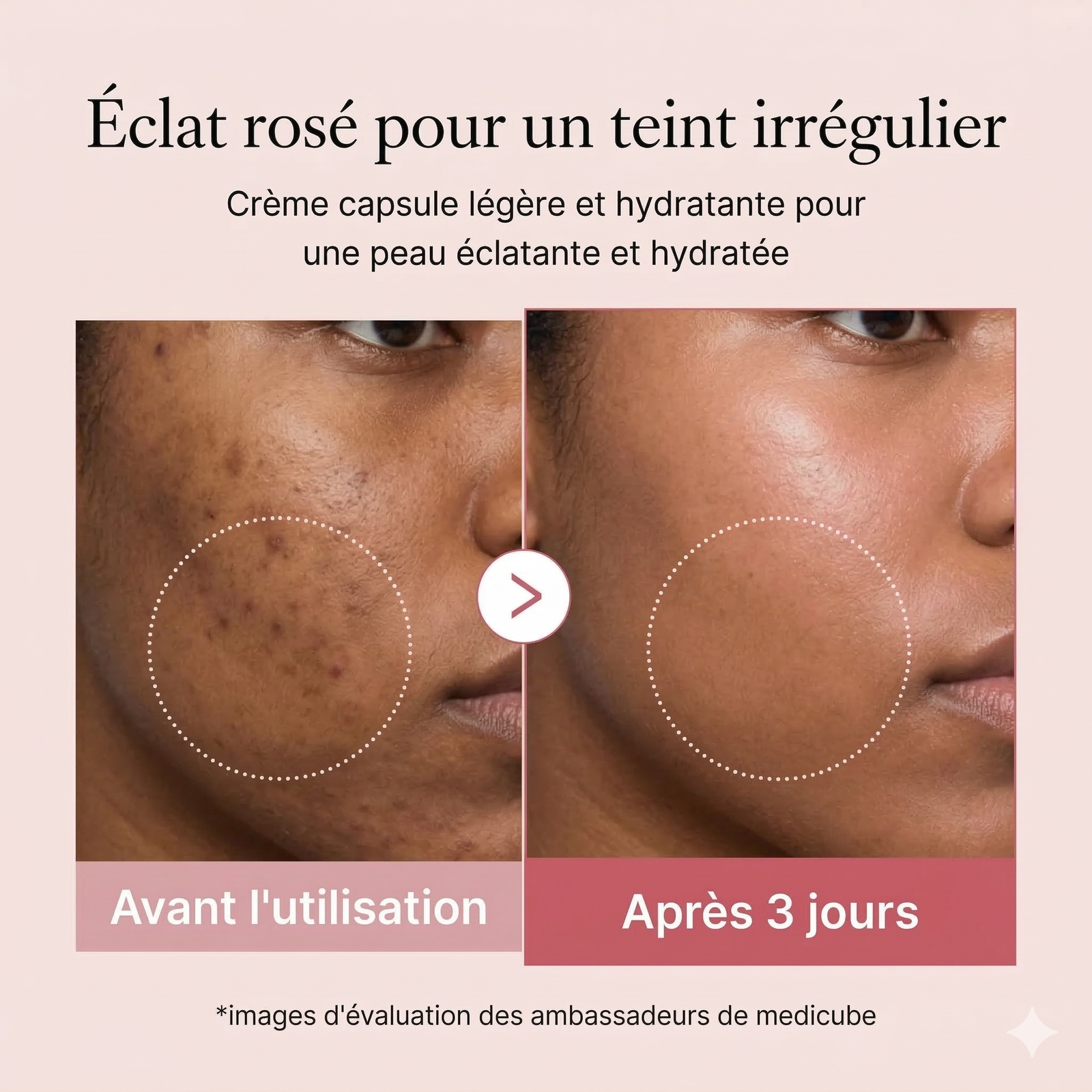 Medicube - Crème Rose capsule au collagène PDRN - 55g (Soin Anti-acné/ tâche) – Image 5