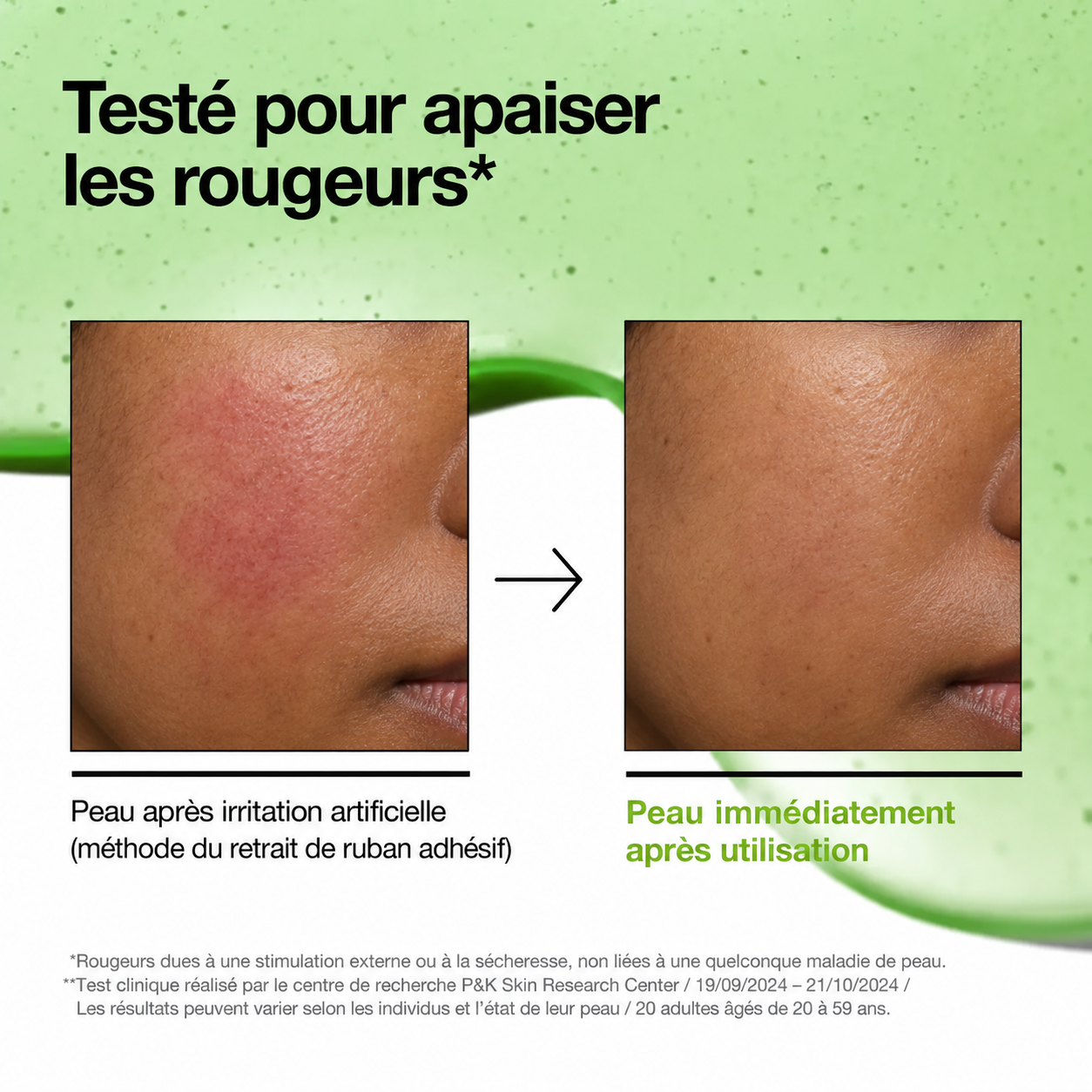 ANUA – Sérum apaisant contre les rougeurs à l'acide azélaïque 10 + acide hyaluronique – Image 6